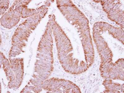 Immunohistochemistry-Paraffin: ATP5F1 Antibody [NBP2-15513]