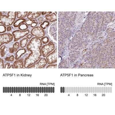 Immunohistochemistry-Paraffin: ATP5F1 Antibody [NBP2-49255]