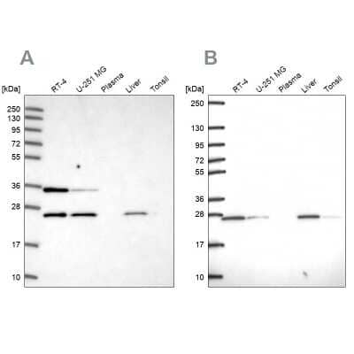 Western Blot: ATP5F1 Antibody [NBP1-91689]