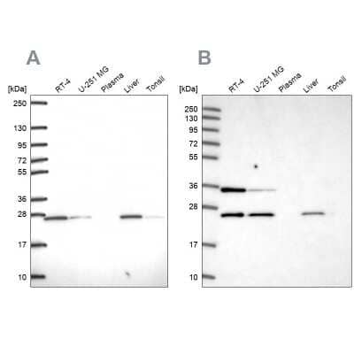 Western Blot: ATP5F1 Antibody [NBP2-49255]