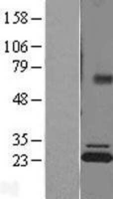 Western Blot: ATP5F1 Overexpression Lysate [NBL1-07822]