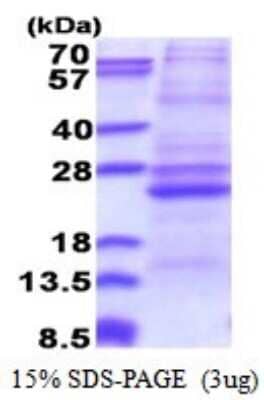 SDS-PAGE: Recombinant Human ATP5F1 His Protein [NBP2-51532]
