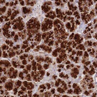 Immunohistochemistry-Paraffin: ATP5G2 Antibody [NBP2-14331]