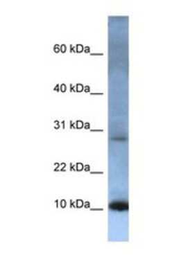 Western Blot: ATP5G2 Antibody [NBP1-69248]