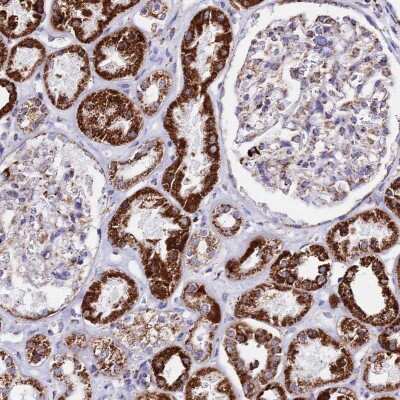 Immunohistochemistry-Paraffin: ATP5H Antibody [NBP2-47545]