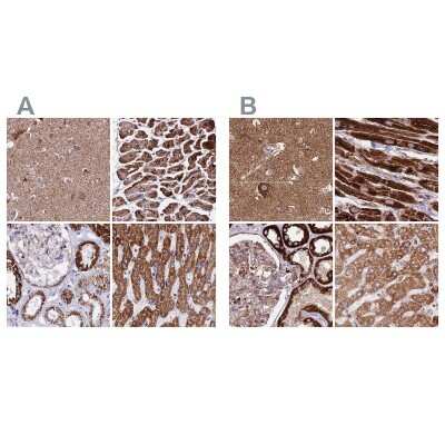Immunohistochemistry-Paraffin: ATP5H Antibody [NBP2-47545]