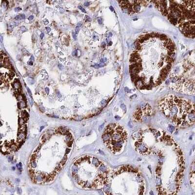 Immunohistochemistry-Paraffin: ATP5H Antibody [NBP2-47545]