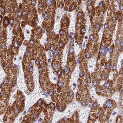 Immunohistochemistry-Paraffin: ATP5H Antibody [NBP2-47545]