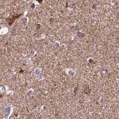 Immunohistochemistry-Paraffin: ATP5H Antibody [NBP2-47545]