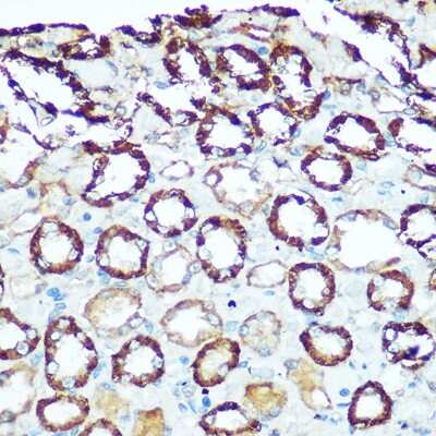 Immunohistochemistry-Paraffin: ATP5H Antibody - BSA Free [NBP2-92443]