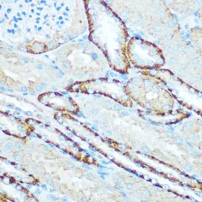 Immunohistochemistry-Paraffin: ATP5H Antibody - BSA Free [NBP2-92443]
