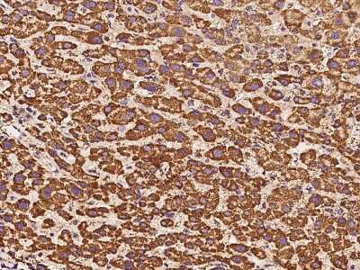 Immunohistochemistry-Paraffin: ATP5H Antibody [NBP2-97512]