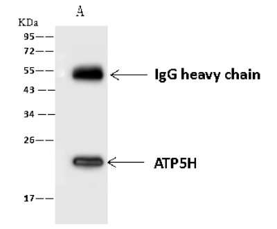 Immunoprecipitation: ATP5H Antibody [NBP2-97512]