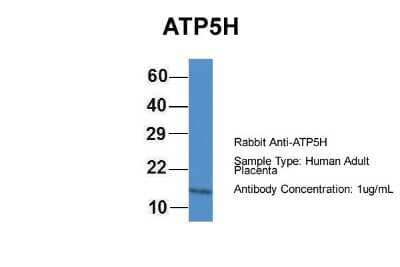 Western Blot: ATP5H Antibody [NBP1-79479]