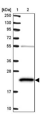 Western Blot: ATP5H Antibody [NBP2-48906]