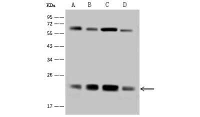 Western Blot: ATP5H Antibody [NBP2-97512]