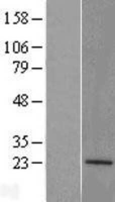 Western Blot: ATP5H Overexpression Lysate [NBL1-07824]