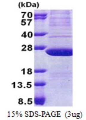 SDS-PAGE: Recombinant Human ATP5H His Protein [NBP2-22700]