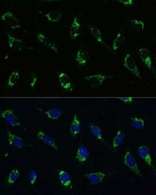 Immunocytochemistry/ Immunofluorescence: ATP5I Antibody - Azide and BSA Free [NBP3-04766]