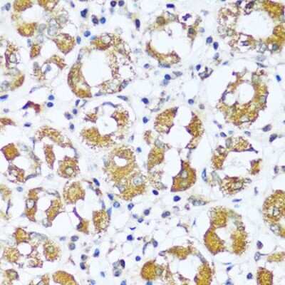 Immunohistochemistry-Paraffin: ATP5I Antibody - Azide and BSA Free [NBP3-04766]