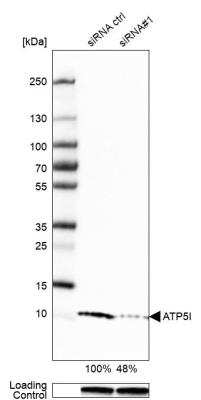 Western Blot: ATP5I Antibody [NBP1-89496]