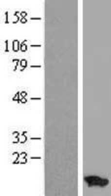 Western Blot: ATP5I Overexpression Lysate [NBP2-07530]