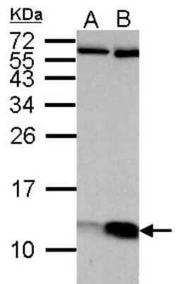 Western Blot: ATP5J Antibody [NBP2-15514]