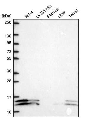 Western Blot: ATP5J2 Antibody [NBP2-57465]