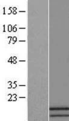 Western Blot: ATP5J2 Overexpression Lysate [NBL1-07827]