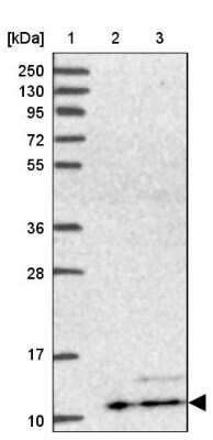 Western Blot: ATP5L Antibody [NBP2-14332]