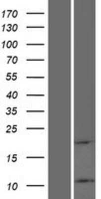 Western Blot: ATP5L2 Overexpression Lysate [NBP2-10137]