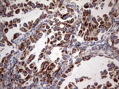 Immunohistochemistry: ATP5O Antibody (OTI2E9) [NBP2-46555]