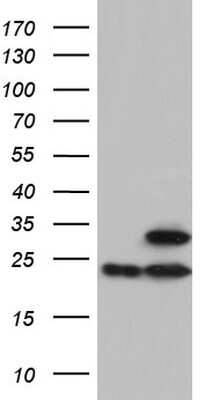 Western Blot: ATP5O Antibody (OTI2E9) [NBP2-46555]