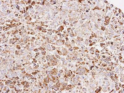 Immunohistochemistry-Paraffin: ATP5O Antibody [NBP1-31646]