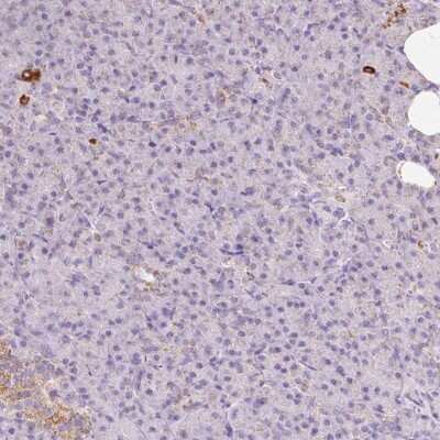 Immunohistochemistry-Paraffin: ATP5O Antibody [NBP2-32602]