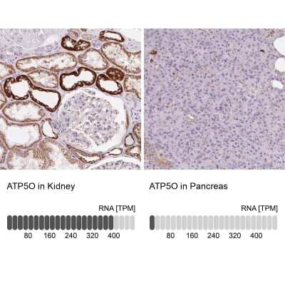 Immunohistochemistry-Paraffin: ATP5O Antibody [NBP2-32602]