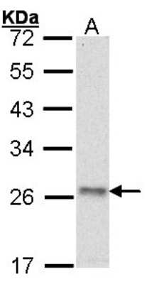 Western Blot: ATP5O Antibody [NBP1-31646]