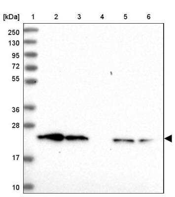 Western Blot: ATP5O Antibody [NBP2-32602]