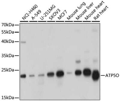 Western Blot: ATP5O AntibodyBSA Free [NBP2-92921]