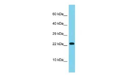 Western Blot: ATP5S Antibody [NBP2-84483]