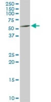 Western Blot: ATP6AP1 Antibody [H00000537-D01P]