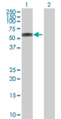Western Blot: ATP6AP1 Antibody [H00000537-D01P]