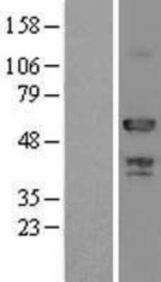 Western Blot: ATP6AP1 Overexpression Lysate [NBL1-07831]