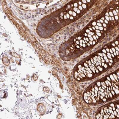 Immunohistochemistry-Paraffin: ATP6AP1L Antibody [NBP2-30899]