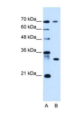 Western Blot: ATP6AP1L Antibody [NBP1-91585]