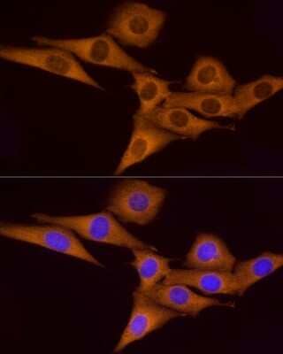 Immunocytochemistry/ Immunofluorescence: ATP6V0A1 Antibody - Azide and BSA Free [NBP2-92219]