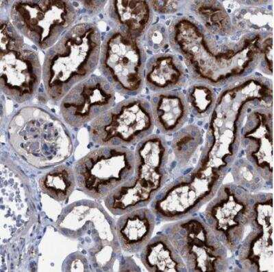 Immunohistochemistry-Paraffin: ATP6V0A1 Antibody [NBP1-89342]