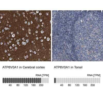 Immunohistochemistry-Paraffin: ATP6V0A1 Antibody [NBP1-89342]