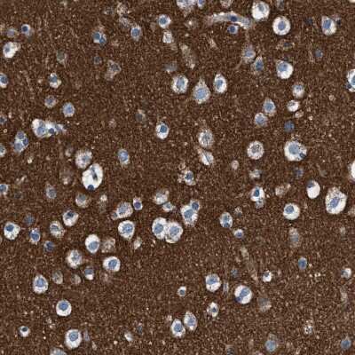 Immunohistochemistry-Paraffin: ATP6V0A1 Antibody [NBP1-89342]