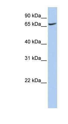 Western Blot: ATP6V0A1 Antibody [NBP1-59949]